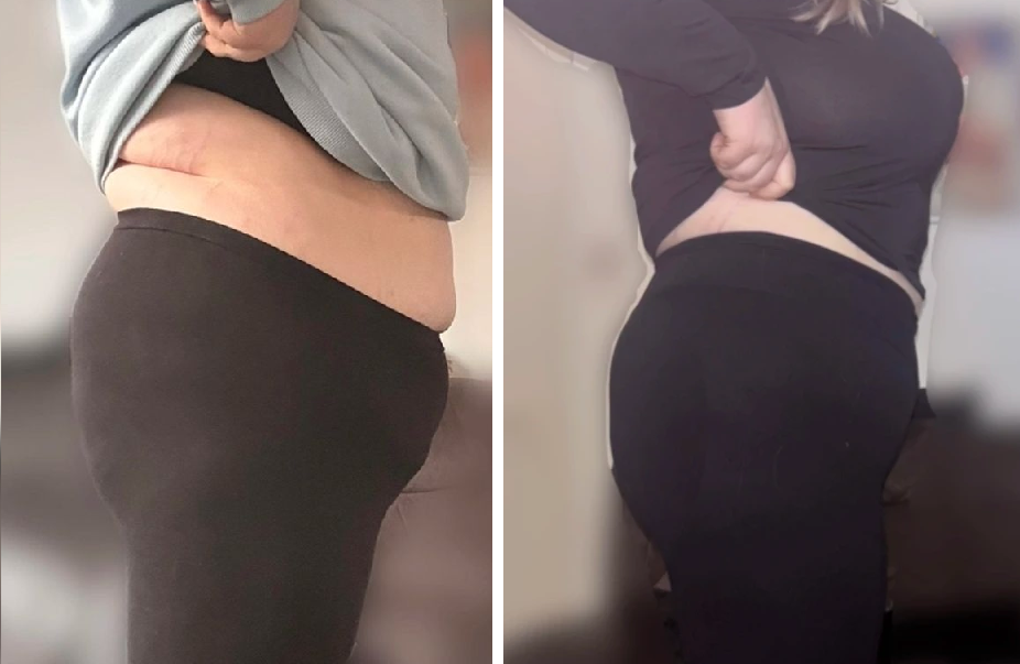 Vero, 38 — −22 kg en 11 meses